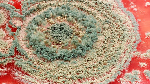 microbes