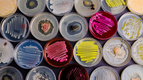 microbes