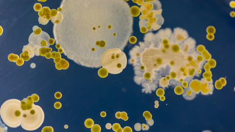 microbes
