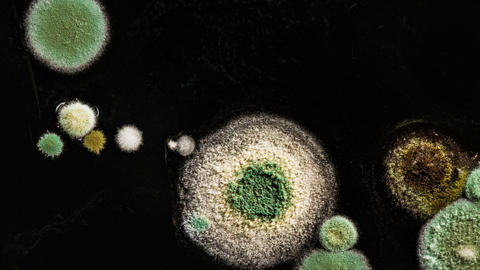 microbes