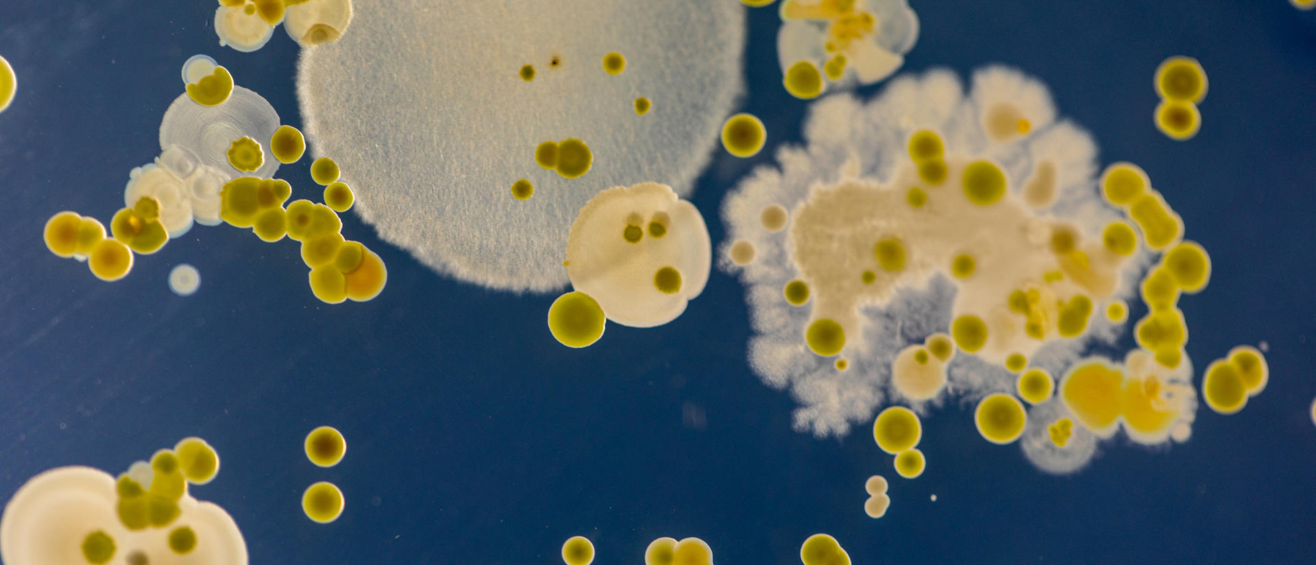 yeast