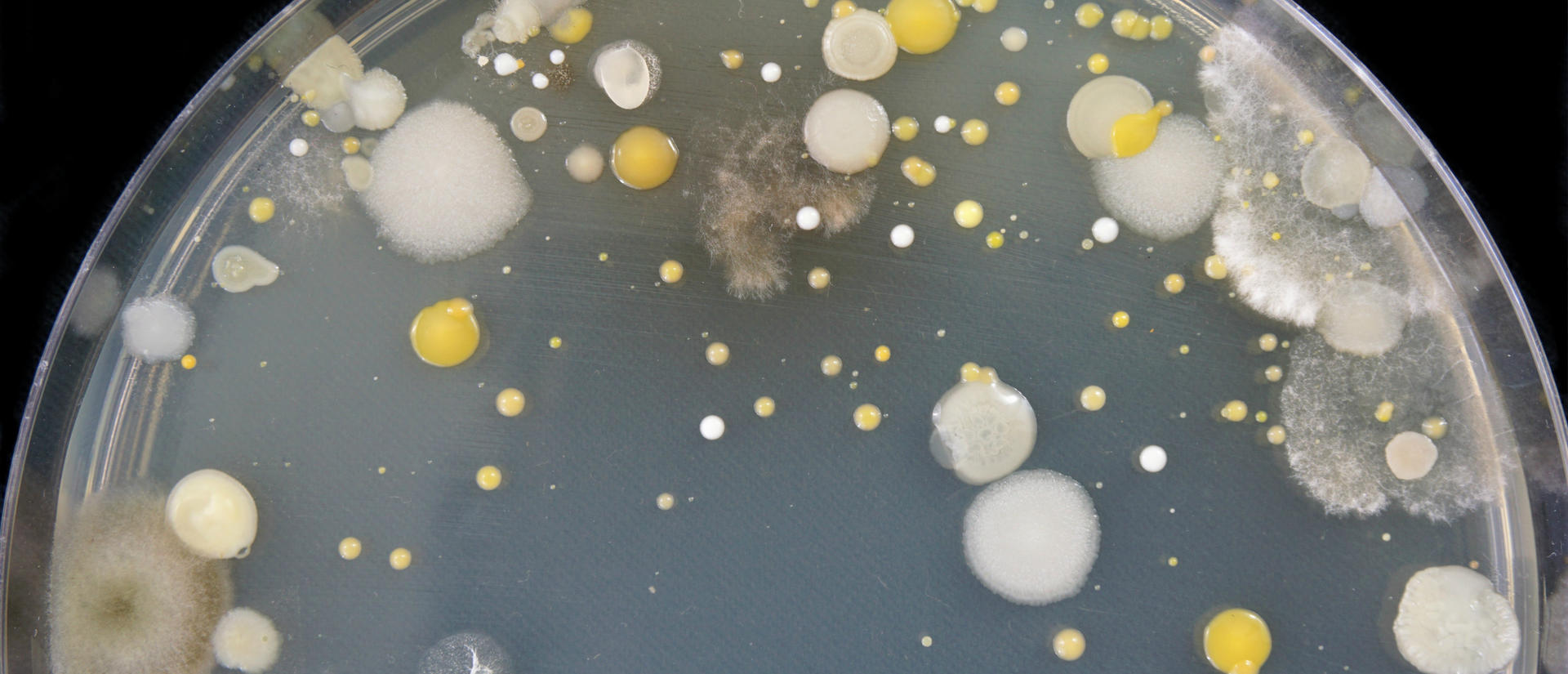 microbes