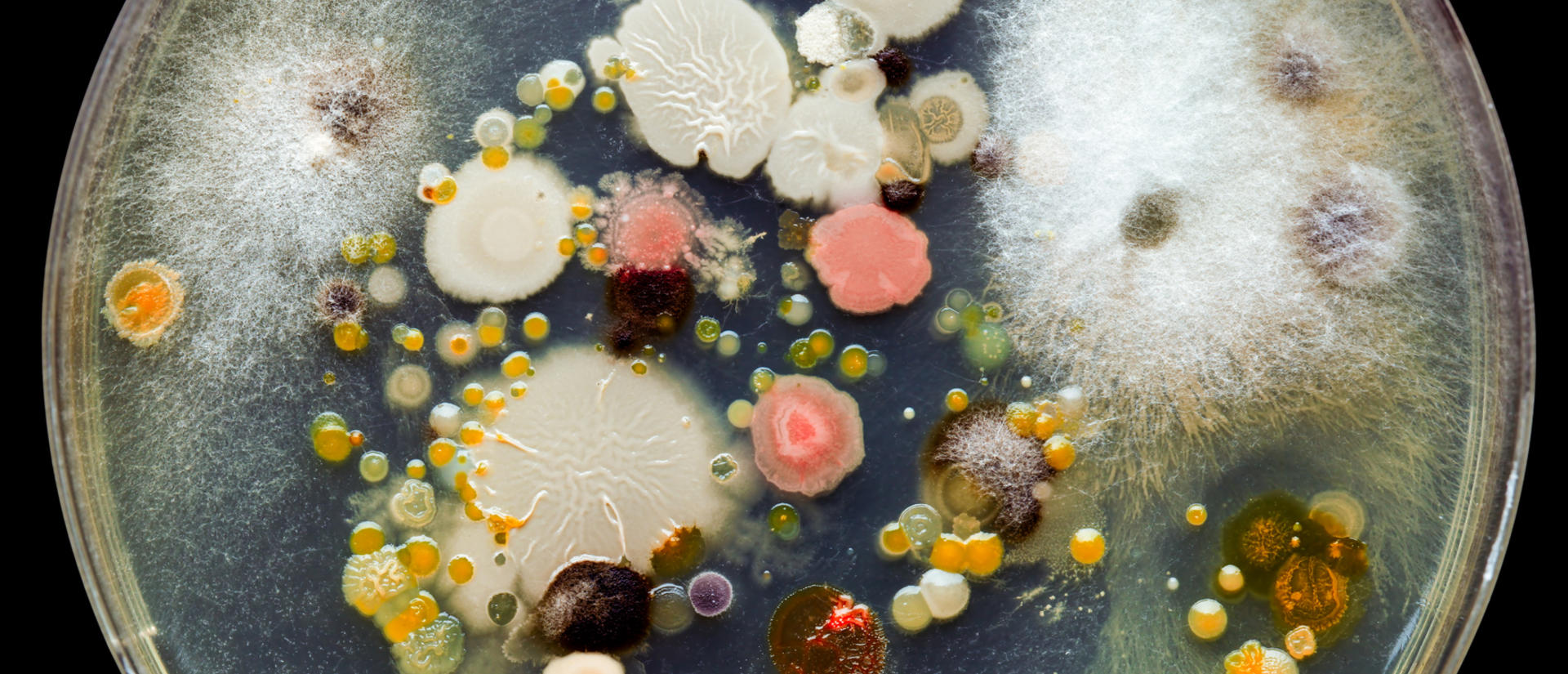 microbes