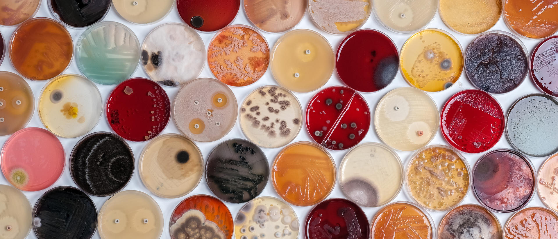 microbes