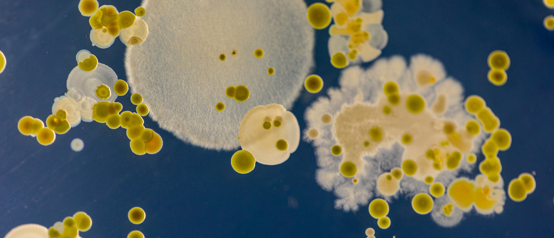 microbes
