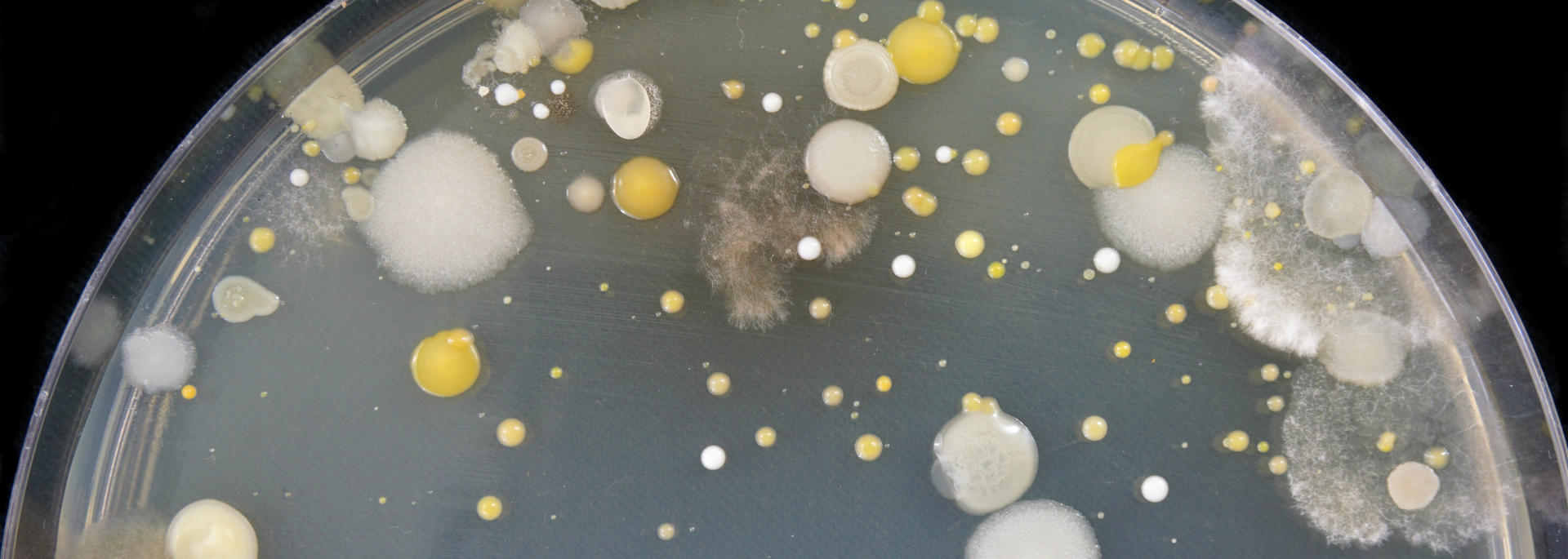 microbes