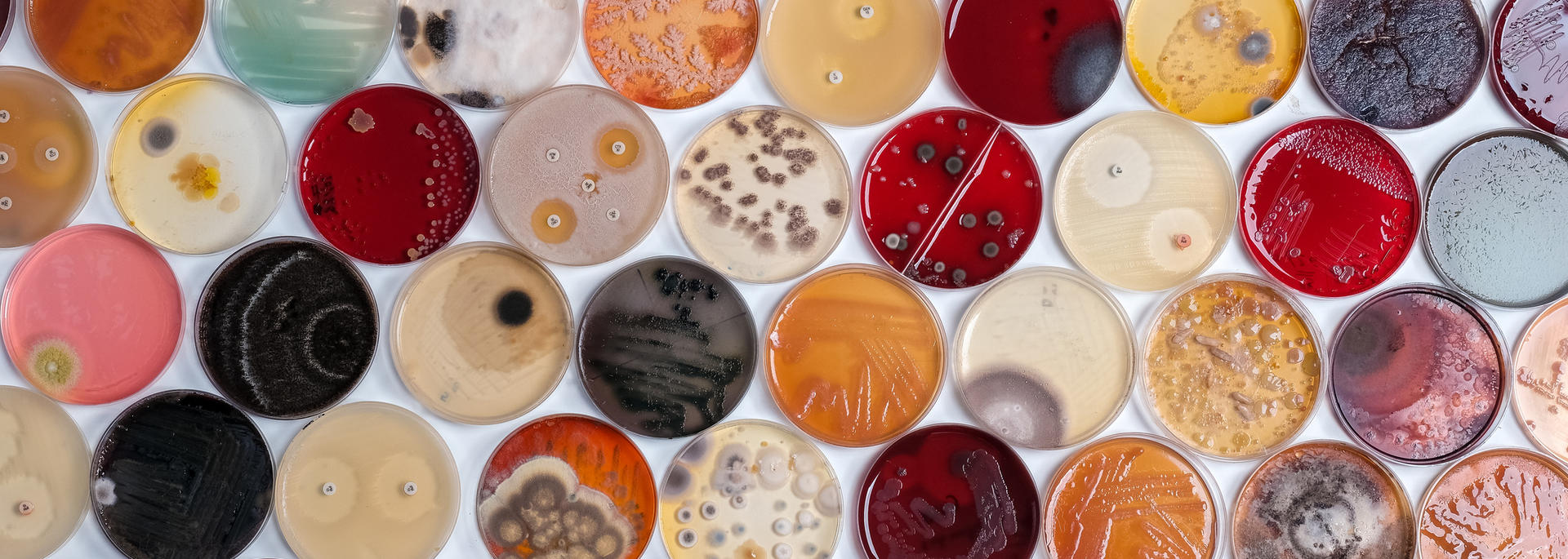 microbes
