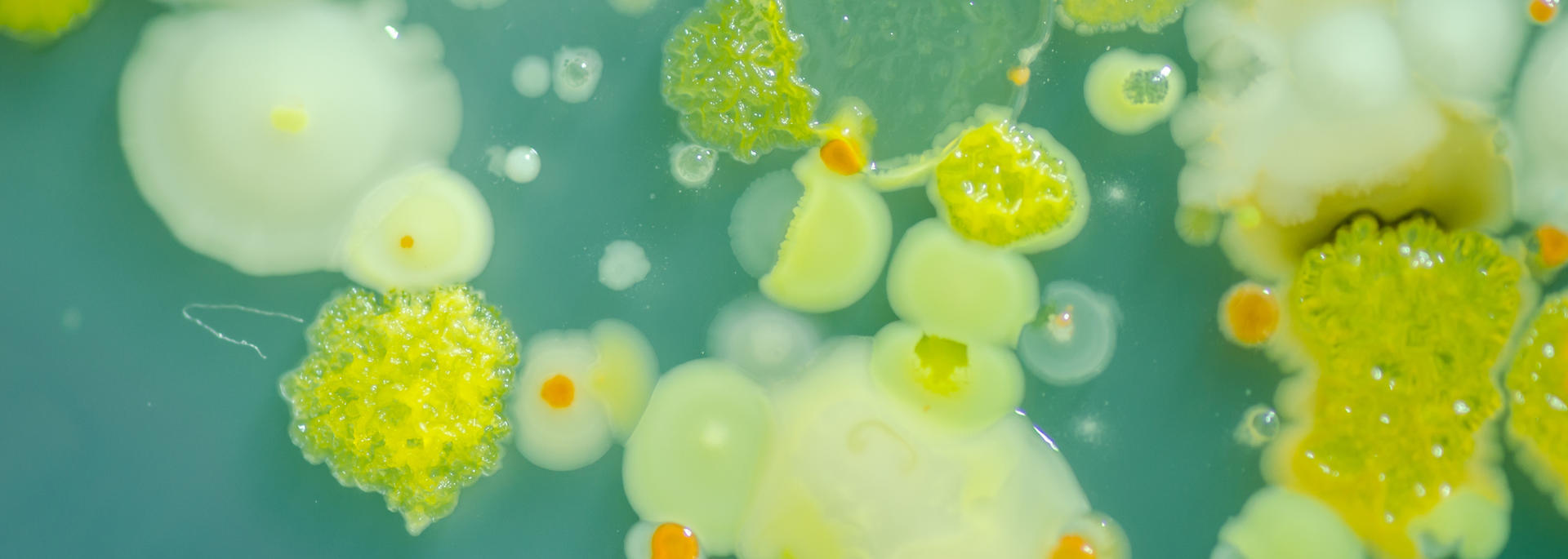 microbes
