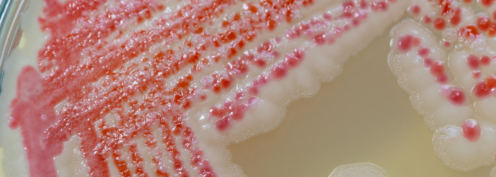 microbes