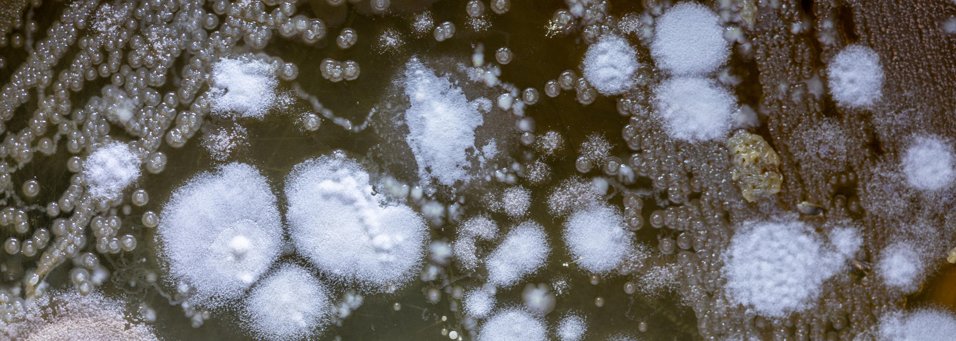 microbes