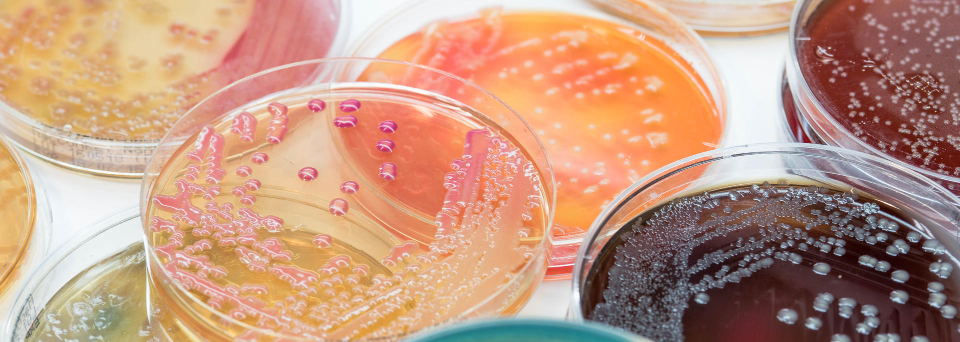 microbes